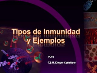 Tipos de Inmunidad  y Ejemplos POR: T.S.U. Kleyber Castellano 