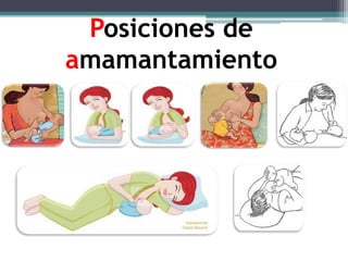 Posiciones de
amamantamiento
 