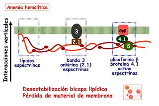 Anemia hemolítica
Interacciones verticales



                                                 3                Gpβ

                                                                  4.1
                                                2.1
                                                                        5


                             lípidos          banda 3         glicoforina β
                           espectrinas     ankirina (2.1)     proteína 4.1
                                            espectrinas           actina
                                                               espectrinas


                              Desestabilización bicapa lipídica
                              Pérdida de material de membrana
 