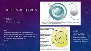 OTROS MULTIFOCALES
• ReZoom
• Multifocal de 3 piezas
MF4
diseño en una sola pieza, acrílico hidrófilo
biconvexo con tres puntos de fijación (diseño en
trípode). El diámetro de la óptica es de 6 mm, y
el diámetro total es de 10,5 mm
VC +4 D
• RESTOR
• LIO DIFRACTIVA
• difracción sólo está
presente en los 3,6 mm
centrales de la óptica
 