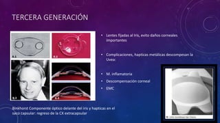 TERCERA GENERACIÓN
• Lentes fijadas al Iris, evito daños corneales
importantes
• Complicaciones, hapticas metálicas descompesan la
Uvea:
• M. inflamatoria
• Descompensación corneal
• EMC
Binkhorst Componente óptico delante del iris y hapticas en el
saco capsular: regreso de la CX extracapsular
 