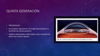 QUINTA GENERACIÓN
• PRECAPSULAR
• los cirujanos regresaron a la cirugía extracapsular y a
las lentes de cámara posterior
• Hapticas descansaban sobre tejido uveal, actualmente
dentro de la bolsa capsular
 