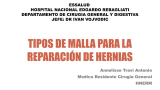 TIPOS DE MALLA PARA LA
REPARACIÓN DE HERNIAS
Annelisse Travi Antonio
Medico Residente Cirugia General
HNERM
ESSALUD
HOSPIT...