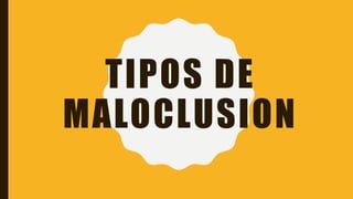 TIPOS DE
MALOCLUSION
 