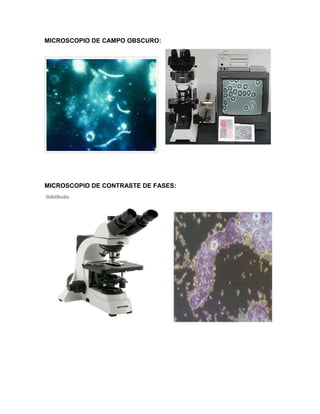 MICROSCOPIO DE CAMPO OBSCURO:
MICROSCOPIO DE CONTRASTE DE FASES:
 