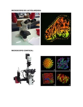 MICROSCOPIO DE LUZ POLARIZADA:
MICROSCOPIO CONFOCAL:
 