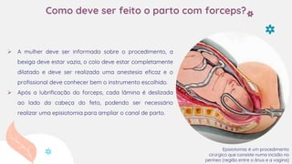 Como deve ser feito o parto com forceps?
 A mulher deve ser informada sobre o procedimento, a
bexiga deve estar vazia, o colo deve estar completamente
dilatado e deve ser realizada uma anestesia eficaz e o
profissional deve conhecer bem o instrumento escolhido.
 Após a lubrificação do forceps, cada lâmina é deslizada
ao lado da cabeça do feto, podendo ser necessário
realizar uma episiotomia para ampliar o canal de parto.
Episiotomia: é um procedimento
cirúrgico que consiste numa incisão no
períneo (região entre o ânus e a vagina)
 