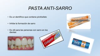 PASTA ANTI-SARRO
• Es un dentífrico que contiene pirofosfato
• Inhibe la formación de sarro
• Es útil para las personas con sarro en los
dientes
 