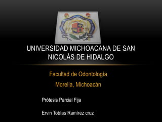 UNIVERSIDAD MICHOACANA DE SAN
NICOLÁS DE HIDALGO
Facultad de Odontología
Morelia, Michoacán
Prótesis Parcial Fija
Ervin Tobías Ramírez cruz

 