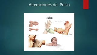 Alteraciones del Pulso
 