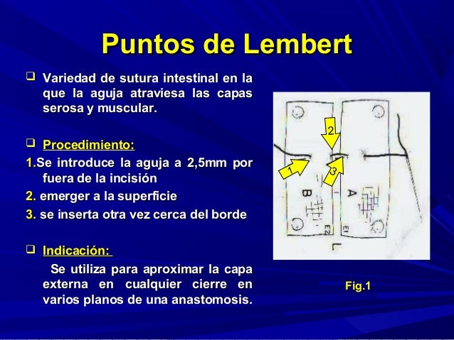 Tipos de puntos , nudos y suturas