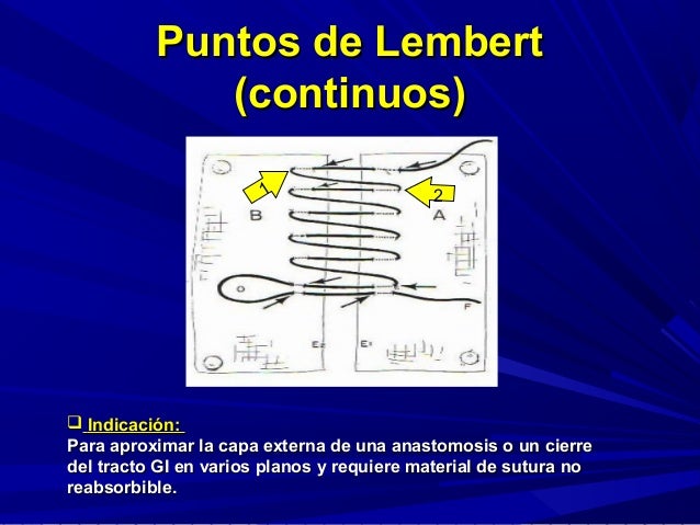 Tipos de puntos , nudos y suturas