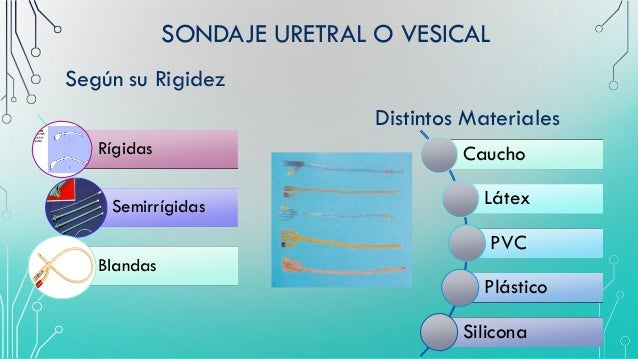 TIPOS DE SONDAS MEDISCA PDF DOWNLOAD TIPOS DE SONDAS MEDISCA PDF DOWNLOAD