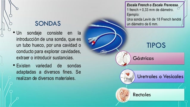 TIPOS DE SONDAS MEDISCA PDF DOWNLOAD TIPOS DE SONDAS MEDISCA PDF DOWNLOAD