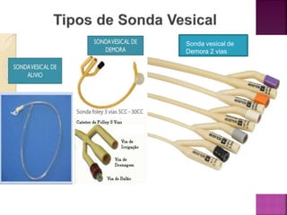 Sonda vesical de
Demora 2 vias
 