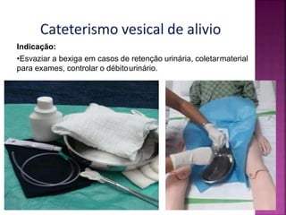 Indicação:
•Esvaziar a bexiga em casos de retenção urinária, coletarmaterial
para exames, controlar o débitourinário.
 