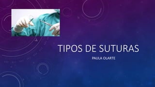 TIPOS DE SUTURAS
PAULA OLARTE
 