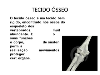 TECIDO ÓSSEO
O tecido ósseo é um tecido bem
rígido, encontrado nos ossos do
esqueleto dos
muit
o
de susten
movimentos
vertebrados,
abundante. E
suas funções
o corpo,
perm a
realização
proteger
cert órgãos.
 
