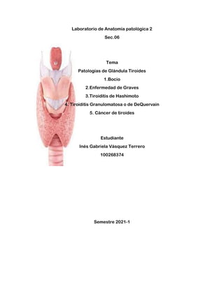 Laboratorio de Anatomía patológica 2
Sec.06
Tema
Patologías de Glándula Tiroides
1.Bocio
2.Enfermedad de Graves
3.Tiroiditis de Hashimoto
4. Tiroiditis Granulomatosa o de DeQuervain
5. Cáncer de tiroides
Estudiante
Inés Gabriela Vásquez Terrero
100268374
Semestre 2021-1
 
