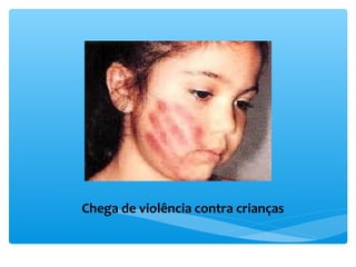 Chega de violência contra crianças
 