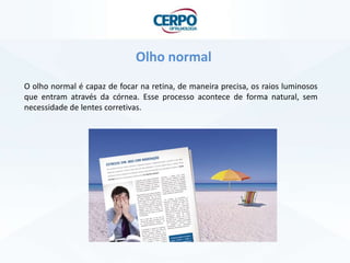 Olho normal
O olho normal é capaz de focar na retina, de maneira precisa, os raios luminosos
que entram através da córnea. Esse processo acontece de forma natural, sem
necessidade de lentes corretivas.
 