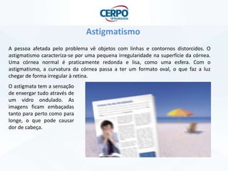 Astigmatismo
A pessoa afetada pelo problema vê objetos com linhas e contornos distorcidos. O
astigmatismo caracteriza-se por uma pequena irregularidade na superfície da córnea.
Uma córnea normal é praticamente redonda e lisa, como uma esfera. Com o
astigmatismo, a curvatura da córnea passa a ter um formato oval, o que faz a luz
chegar de forma irregular à retina.
O astigmata tem a sensação
de enxergar tudo através de
um vidro ondulado. As
imagens ficam embaçadas
tanto para perto como para
longe, o que pode causar
dor de cabeça.
 