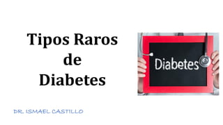Tipos Raros
de
Diabetes
DR. ISMAEL CASTILLO
 