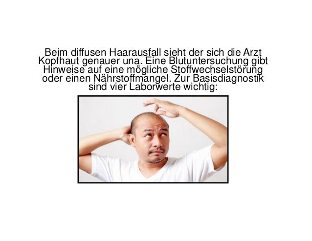 Kreisrunder Haarausfall Alopecia Areata Symptome Therapie Kreisrunder Haarausfall Alopecia Areata Symptome Therapie