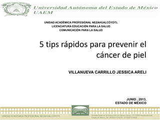 5 tips rápidos para prevenir el
cáncer de piel
VILLANUEVA CARRILLO JESSICA ARELI
JUNIO , 2013,
ESTADO DE MÉXICO
UNIDAD ACADÉMICA PROFESIONAL NEZAHUALCÓYOTL
LICENCIATURA EDUCACIÓN PARA LA SALUD
COMUNICACIÓN PARA LA SALUD
 