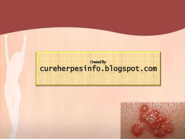 Genital Herpes In Women Genital Herpes In Women