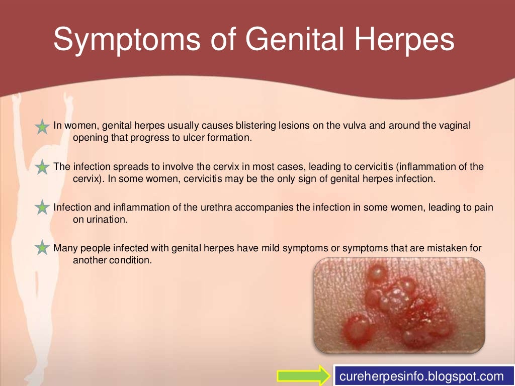 Genital Herpes In Women