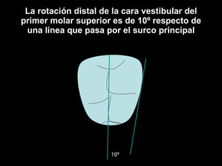 La rotación distal de la cara vestibular del primer molar superior es de 10º respecto de una línea que pasa por el surco principal ,[object Object],10º 