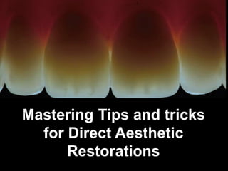 Mastering Tips and tricks
for Direct Aesthetic
Restorations
 
