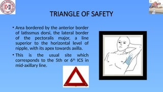 Tips and Tricks of Chest Drain Tube (Tube Thoracostomy) | PPTX