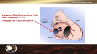 Tips and Tricks for ASD Closure in Adult.pptx