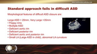Tips and Tricks for ASD Closure in Adult.pptx