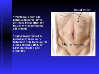 Tips and Tricks in Laparoscopic Dissection of Adhesions | PPT