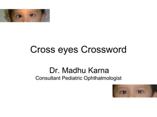 Cross eyes Crossword
Dr. Madhu Karna
Consultant Pediatric Ophthalmologist
 