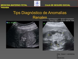 MEDICINA MATERNO FETAL CAJA DE SEGURO SOCIAL PANAMA        TipsDiagnòstico de Anomalìas Renales DRA. TANIA T. HERRERA R. MEDICINA MATERNOFETAL 