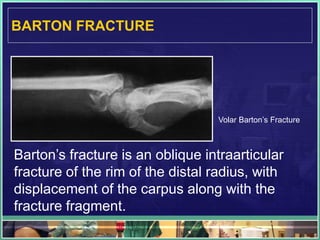 Tips for interpreting x ray in trauma | PDF