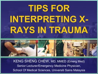 TIPS FOR
INTERPRETING X-
RAYS IN TRAUMA


KENG SHENG CHEW, MD, MMED (Emerg Med)
  Senior Lecturer/Emergency Medicine Physician,
School Of Medical Sciences, Universiti Sains Malaysia
 