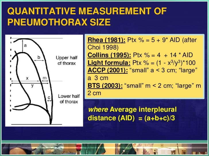 Tips for interpreting x ray in trauma
