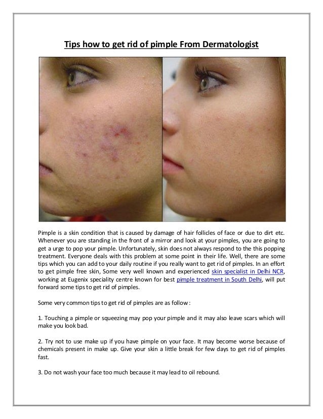 pimples specialist doctor