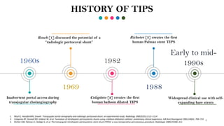 1960s
Inadvertent portal access during
transjugular cholangiography
1969
Rosch [1] discussed the potential of a
“radiologic portocaval shunt”
1982
Colapinto [2] creates the first
human balloon dilated TIPS
1988
Richeter [3] creates the first
human Palmaz stent TIPS
Early to mid-
1990s
Widespread clinical use with self-
expanding bare stents
HISTORY OF TIPS
1. Rösch J, HanafeeWN, SnowH. Transjugular portal venography and radiologic portacaval shunt: an experimental study. Radiology 1969;92(5):1112–1114
2. Colapinto RF, Stronell RD, Gildiner M, et al. Formation of intrahepatic portosystemic shunts using a balloon dilatation catheter: preliminary clinical experience. AJR AmJ Roentgenol 1983;140(4): 709–714
3. Richter GM, Palmaz JC, Noldge G, et al. The transjugular intrahepatic portosystemic stent-shunt (TIPSS): a new nonoperative percutaneous procedure. Radiologie 1989;29:406–411
8
 
