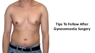 Tips To Follow After
Gynecomastia Surgery
 