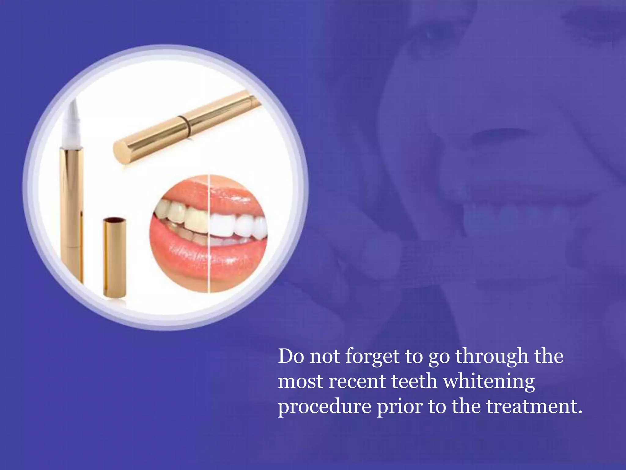 Do not forget to go through the
most recent teeth whitening
procedure prior to the treatment.