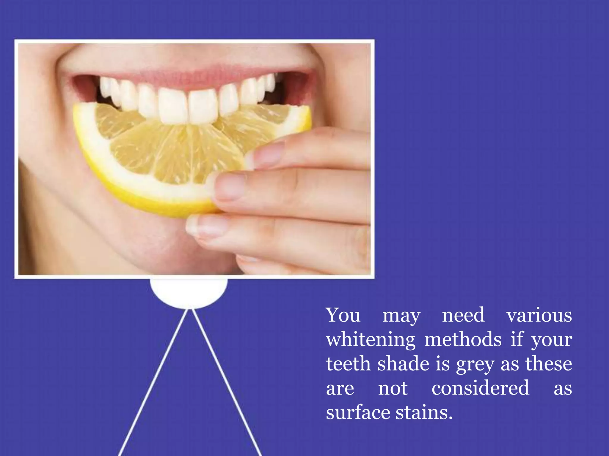 You may need various
whitening methods if your
teeth shade is grey as these
are not considered as
surface stains.