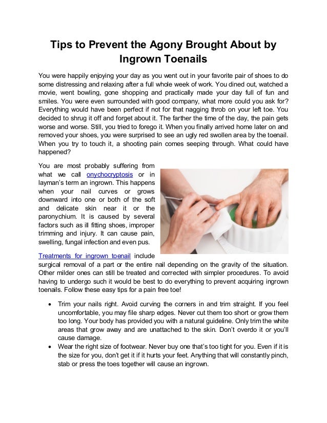 Tips to prevent the agony brought about by ingrown toenails