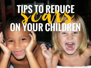 TIPS TO REDUCE
ON YOUR CHILDREN
scars
 