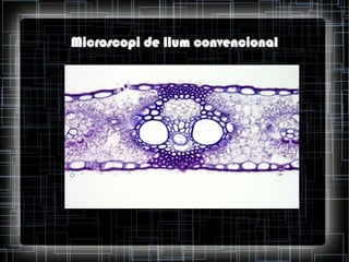 Microscopi de llum convencional

 